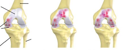 articular