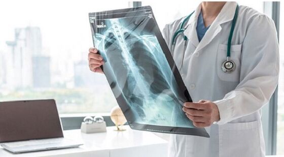 X-ray diagnosis of pain under the left shoulder blade