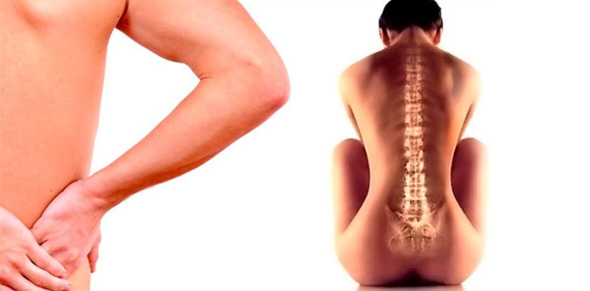 back pain caused by osteochondrosis