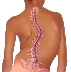 The curvature of the spine leads to osteochondrosis